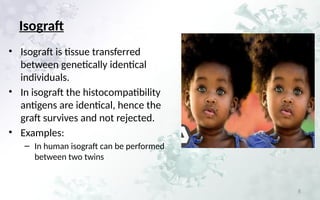 Isograft Examples Transplantation immunology autograft, allograft...xenograft.pptx