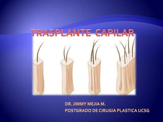 TRASPLANTE  CAPILAR DR. JIMMY MEJIA M. POSTGRADO DE CIRUGIA PLASTICA UCSG 