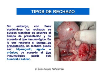 Sin embargo, con fines académicos los rechazos se pueden clasificar de acuerdo al tiempo de presentación y de acuerdo al tipo inmunológico. En lo que respecta al  tiempo de presentación , un rechazo puede ser:  hiperagudo, agudo o crónico;  de acuerdo al  tipo inmunológico  puede ser:  humoral o celular. TIPOS DE RECHAZO 