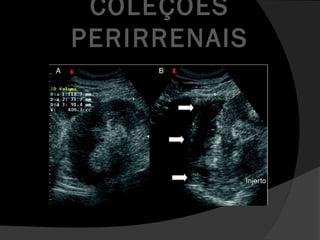 COLEÇÕES
PERIRRENAIS
 