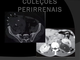 COLEÇÕES
PERIRRENAIS
 