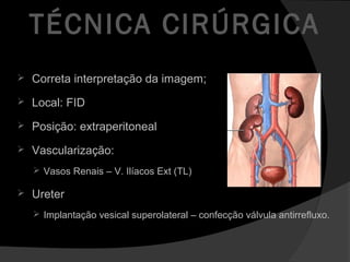 TÉCNICA CIRÚRGICA
 Correta interpretação da imagem;
 Local: FID
 Posição: extraperitoneal
 Vascularização:
 Vasos Renais – V. Ilíacos Ext (TL)
 Ureter
 Implantação vesical superolateral – confecção válvula antirrefluxo.
 