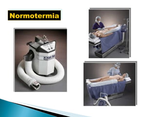 Normotermia 