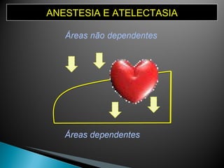 ANESTESIA E ATELECTASIA 