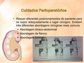 • Requer diferentes posicionamentos do paciente para
se expor adequadamente o lugar cirúrgico. Existem
três diferentes abordagens cirúrgicas mais comuns:
 Abordagem tóraco-abdominal
 Abordagem de flanco;
 Abordagem lombar;

 