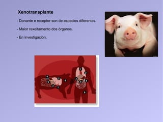Xenotransplante
- Donante e receptor son de especies diferentes.
- Maior rexeitamento dos órganos.
- En investigación.
 