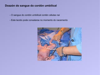 Doazón do sangue do cordón umbilical
- O sangue do cordón umbilical contén células nai
- Este tecido pode conxelarse no momento do nacemento
 