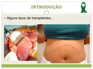  Alguns tipos de transplantes...
INTRODUÇÃO
 
