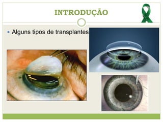  Alguns tipos de transplantes...
INTRODUÇÃO
 