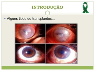  Alguns tipos de transplantes...
INTRODUÇÃO
 