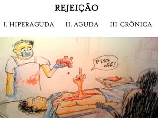 REJEIÇÃO
I. HIPERAGUDA II. AGUDA III. CRÔNICA
 