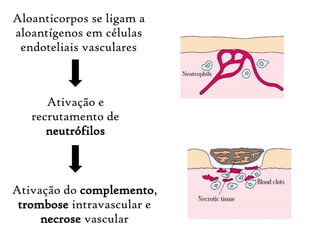 Aloanticorpos se ligam a
aloantígenos em células
endoteliais vasculares
Ativação e
recrutamento de
neutrófilos
Ativação do complemento,
trombose intravascular e
necrose vascular
 