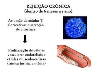 REJEIÇÃO CRÔNICA
(dentro de 6 meses a 1 ano)
Ativação de células T
alorreativas e secreção
de citocinas
Proliferação de células
vasculares endoteliais e
células musculares lisas
(túnica íntima e média)
 