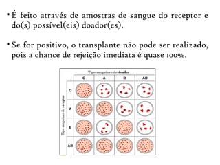 ●
É feito através de amostras de sangue do receptor e
do(s) possível(eis) doador(es).
●
Se for positivo, o transplante não pode ser realizado,
pois a chance de rejeição imediata é quase 100%.
 
