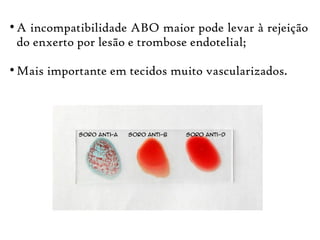 ●
A incompatibilidade ABO maior pode levar à rejeição
do enxerto por lesão e trombose endotelial;
●
Mais importante em tecidos muito vascularizados.
 