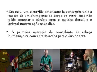 ●
Em 1970, um cirurgião americano já conseguiu unir a
cabeça de um chimpanzé ao corpo de outro, mas não
pôde conectar o cérebro com o espinha dorsal e o
animal morreu após nove dias.
●
A primeira operação de transplante de cabeça
humana, está com data marcada para o ano de 2017.
 