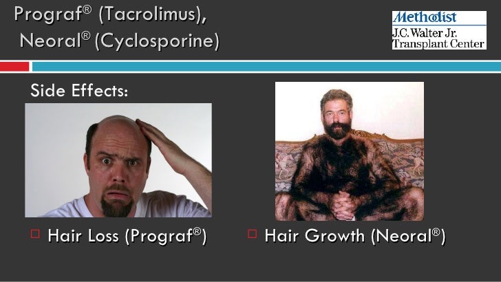 tacrolimus side effects hair loss