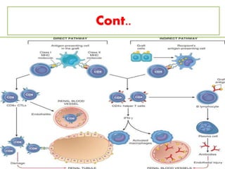 Transplant rejection and GVD | PPTX