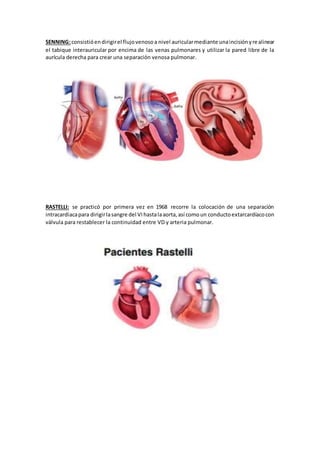 TRANSPOSICIÓN DE LAS GRANDES ARTERIAS | DOCX