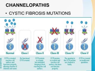 CHANNELOPATHIS
• CYSTIC FIBROSIS MUTATIONS
 