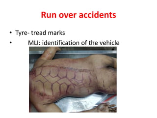 Run over accidents
• Tyre- tread marks
• MLI: identification of the vehicle
 