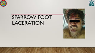 SPARROW FOOT
LACERATION
 