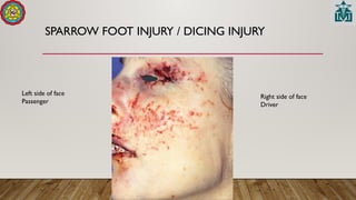 SPARROW FOOT INJURY / DICING INJURY
Left side of face
Passenger
Right side of face
Driver
 