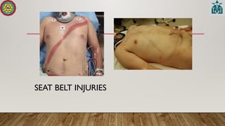 SEAT BELT INJURIES
 