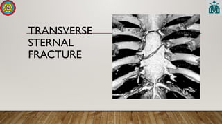 TRANSVERSE
STERNAL
FRACTURE
 