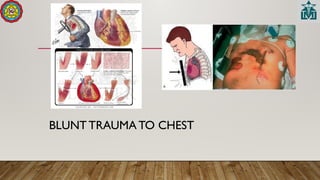 BLUNT TRAUMA TO CHEST
 
