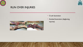 RUN OVER INJURIES
• Crush laceration
• Avulsed laceration (degloving
injuries)
 