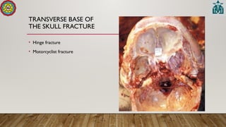 TRANSVERSE BASE OF
THE SKULL FRACTURE
• Hinge fracture
• Motorcyclist fracture
 
