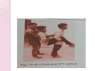 Fore Aft Method Transportation of injured | PPTX