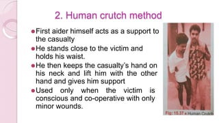 2. Human crutch method
⚫First aider himself acts as a support to
the casualty
⚫He stands close to the victim and
holds his waist.
⚫He then keeps the casualty’s hand on
his neck and lift him with the other
hand and gives him support
⚫Used only when the victim is
conscious and co-operative with only
minor wounds.
 