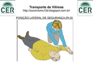 Transporte de Vítimas
http://socorrismo12d.blogspot.com.br/
POSIÇÃO LATERAL DE SEGURANÇA (PLS)
 