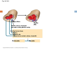 Fig. 42-18-3
Collagen fibers
Platelet
plug
Platelet releases chemicals
that make nearby platelets sticky
Clotting factors from:
Platelets
Damaged cells
Plasma (factors include calcium, vitamin K)
Prothrombin Thrombin
 