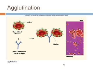76
Agglutination
Copyright © The McGraw-Hill Companies, Inc. Permission required for reproduction or display.
Agglutination
binding
500×
clumping
antigen
Type A blood
of donor
anti- A antibody of
type Brecipient
 