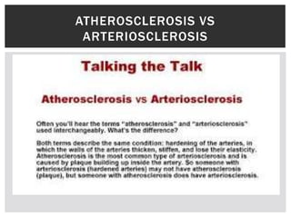 ATHEROSCLEROSIS VS
ARTERIOSCLEROSIS
 