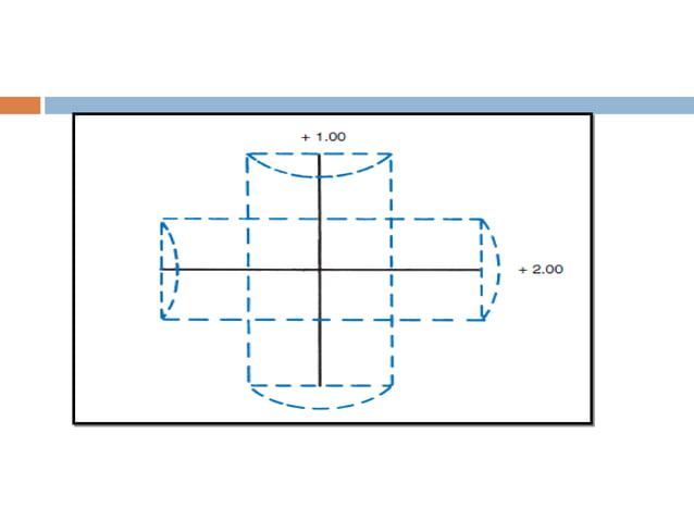 Transposition | PPT | Eye and Vision Conditions | Diseases and Conditions