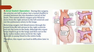 Transposition of Great Arteries(TGA) by Суд Ааруши.pptx