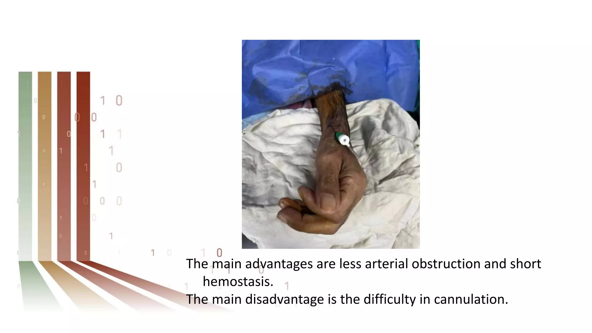 The main advantages are less arterial obstruction and short
hemostasis.
The main disadvantage is the difficulty in cannulation.
 