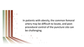 In patients with obesity, the common femoral
artery may be difficult to locate, and post-
procedural control of the puncture site can
be challenging.
 