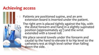 Achieving access
Patients are positioned supine, and an arm
extension board is inserted under the patient.
The right arm is placed tightly against the hip, with
the distal forearm and hand in a slightly supinated
position (approximately 45°) and the wrist
extended with a towel roll.
We place several towels under the forearm and
caudal to the hand to elevate it to hip level so the
catheters rest at thigh level rather than falling
down the side.
 