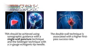 TRA should be achieved using
sonographic guidance with a
single-wall puncture technique
and the Seldinger technique with
a 21-gauge echogenic-tip needle.
The double-wall technique is
associated with a higher first-
pass success rate.
 