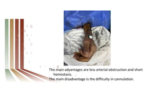 The main advantages are less arterial obstruction and short
hemostasis.
The main disadvantage is the difficulty in cannulation.
 