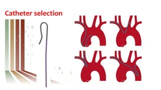 Catheter selection
 