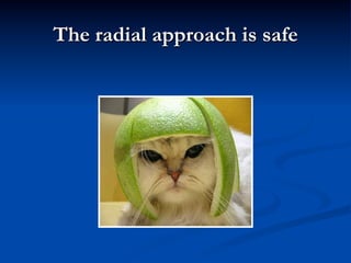 The radial approach is safe
 