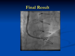 Final Result
 
