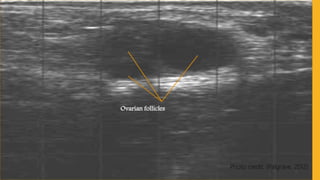 Transrectal ultrasonography in reproductive management of cattle | PPTX