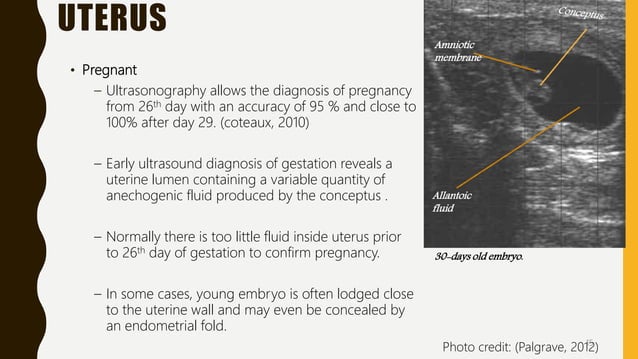 Transrectal ultrasonography in reproductive management of cattle | PPTX